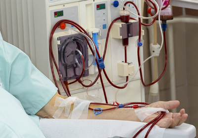 Save 70years old men life to complete dialysis