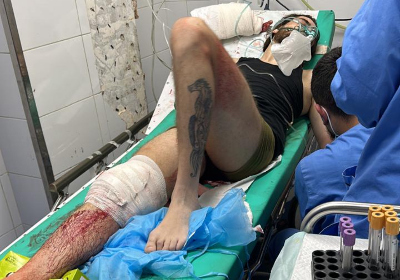 Save Fadi to live his hand and leg