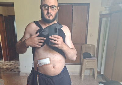 Heart transplantation