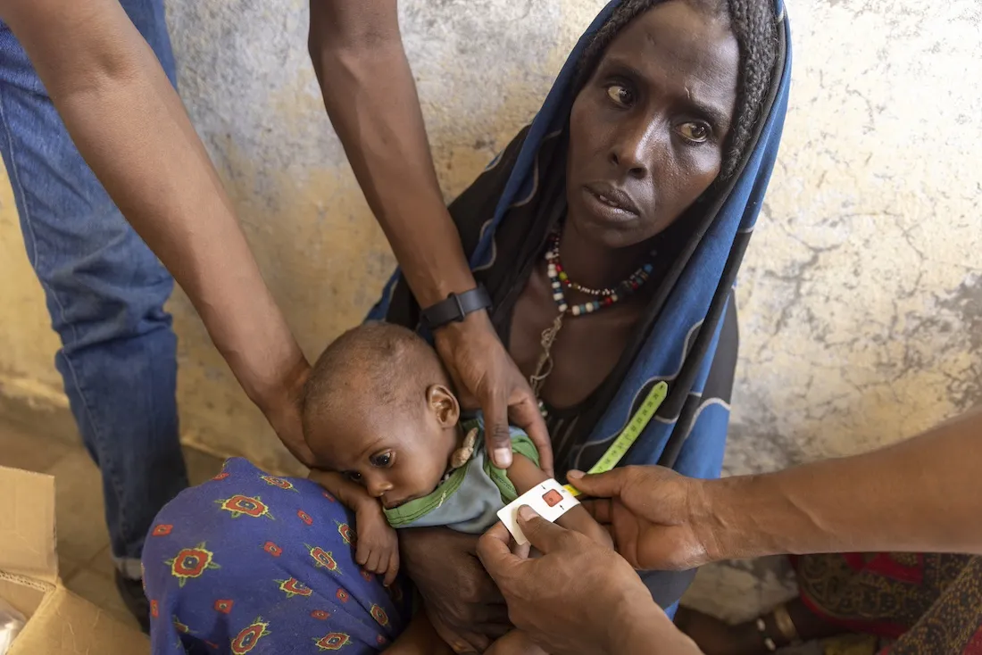mother and starving child in Ethiopia