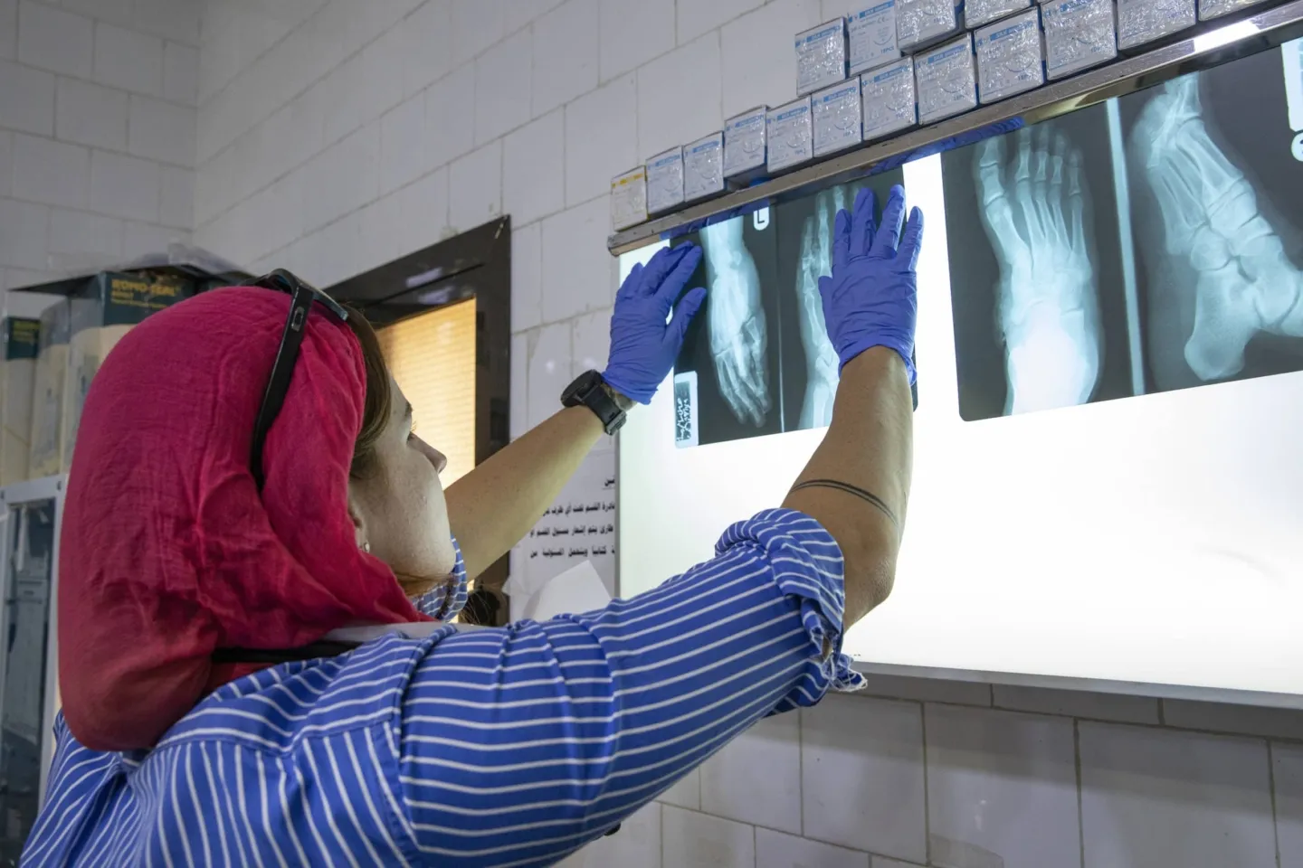 MedGlobal doctor examining an X-ray