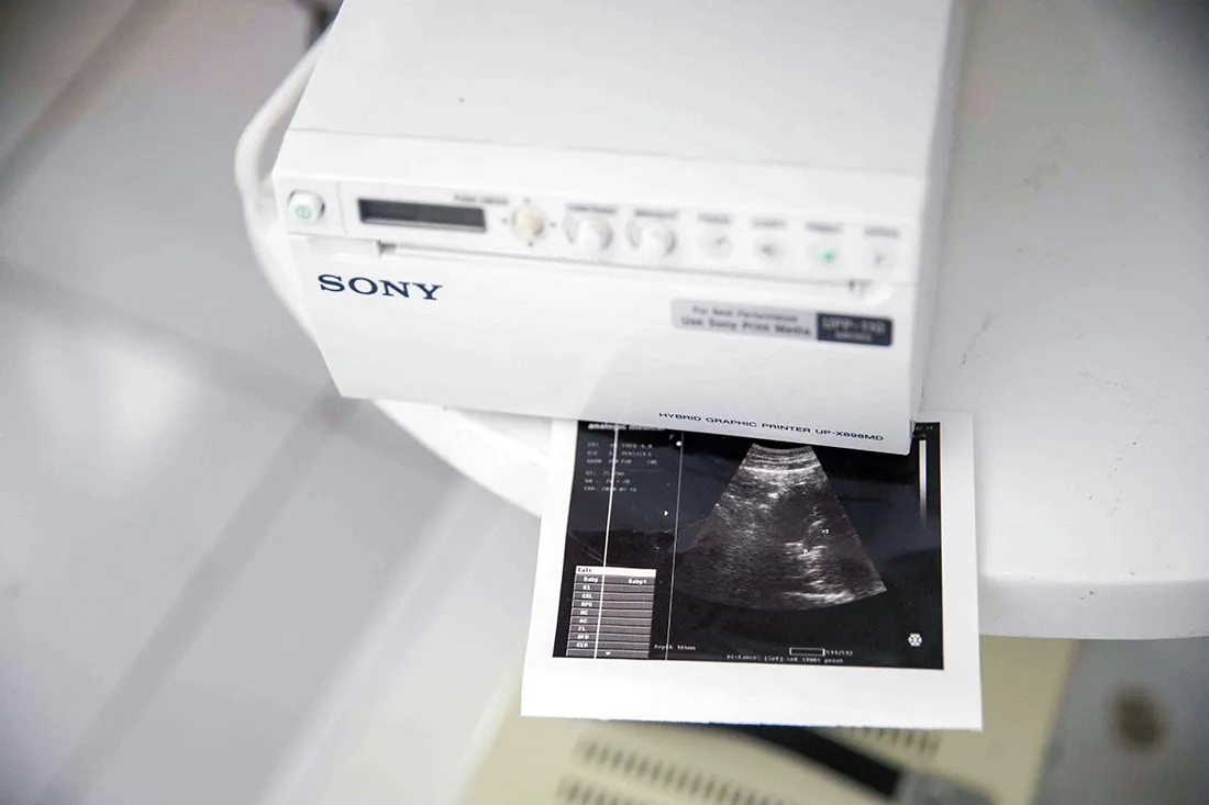 sonogram